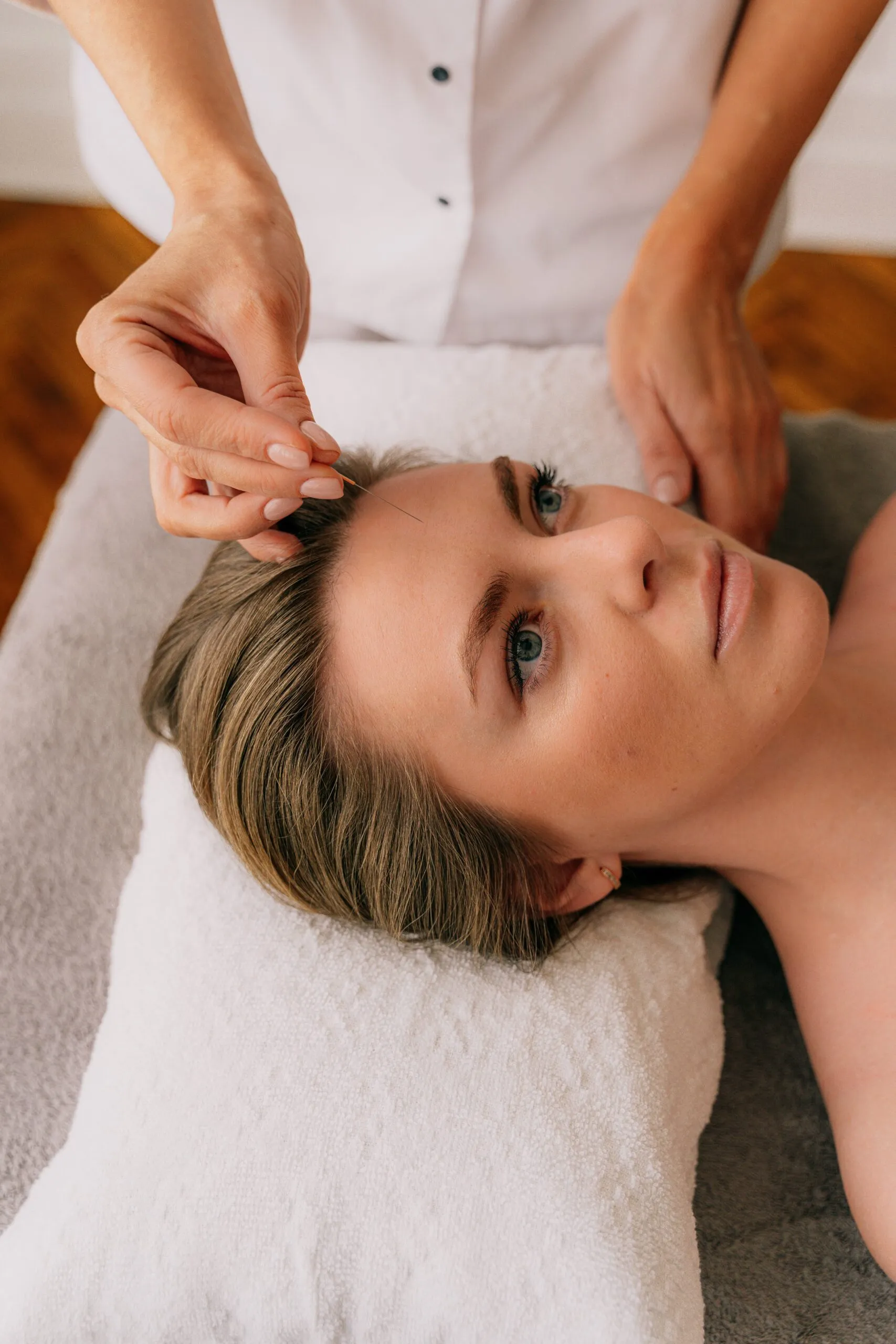 Cosmetic Acupuncture Facial Rejuvenation