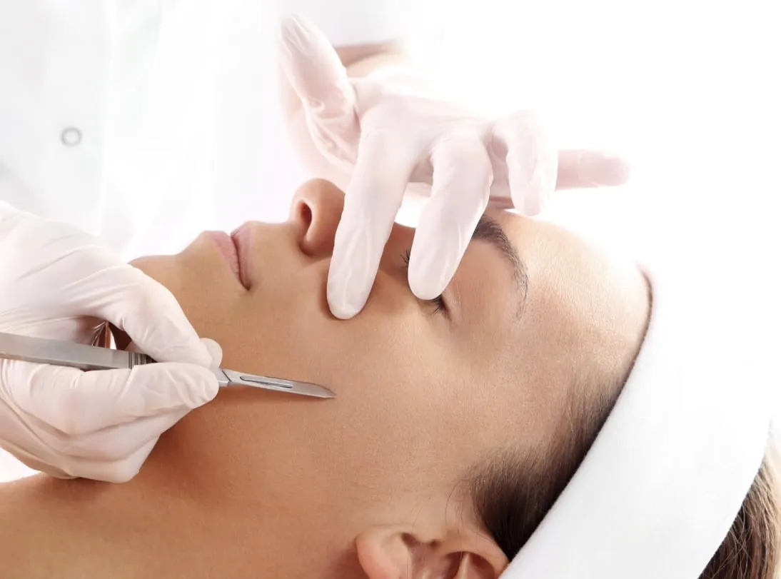 Dermaplaning