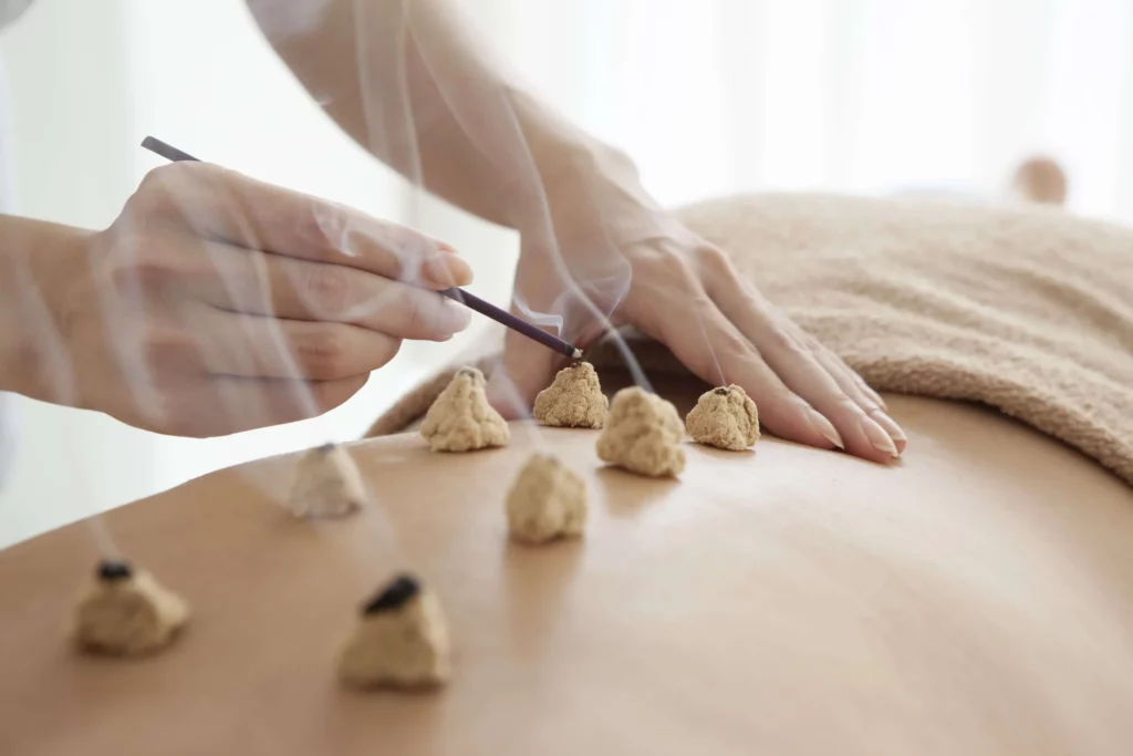 Can Moxibustion Newport Beach Orange county