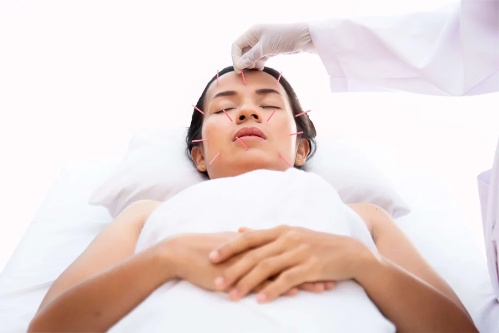 How Much Should Acupuncture Cost