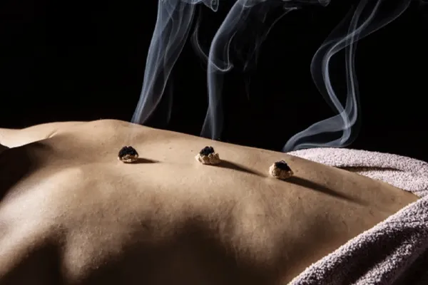Moxibustion