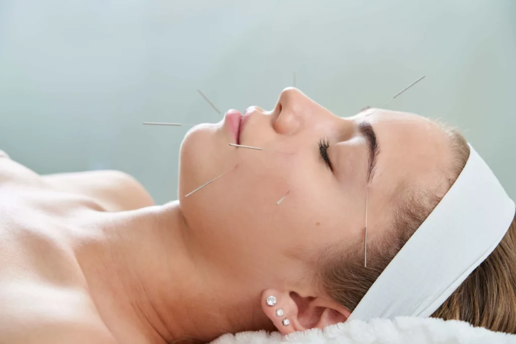 acupuncture cost
