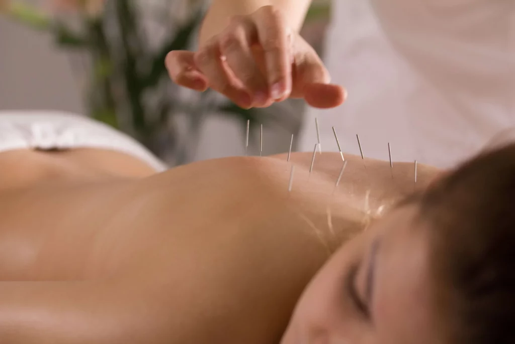 alternative medicine for allergy eczema