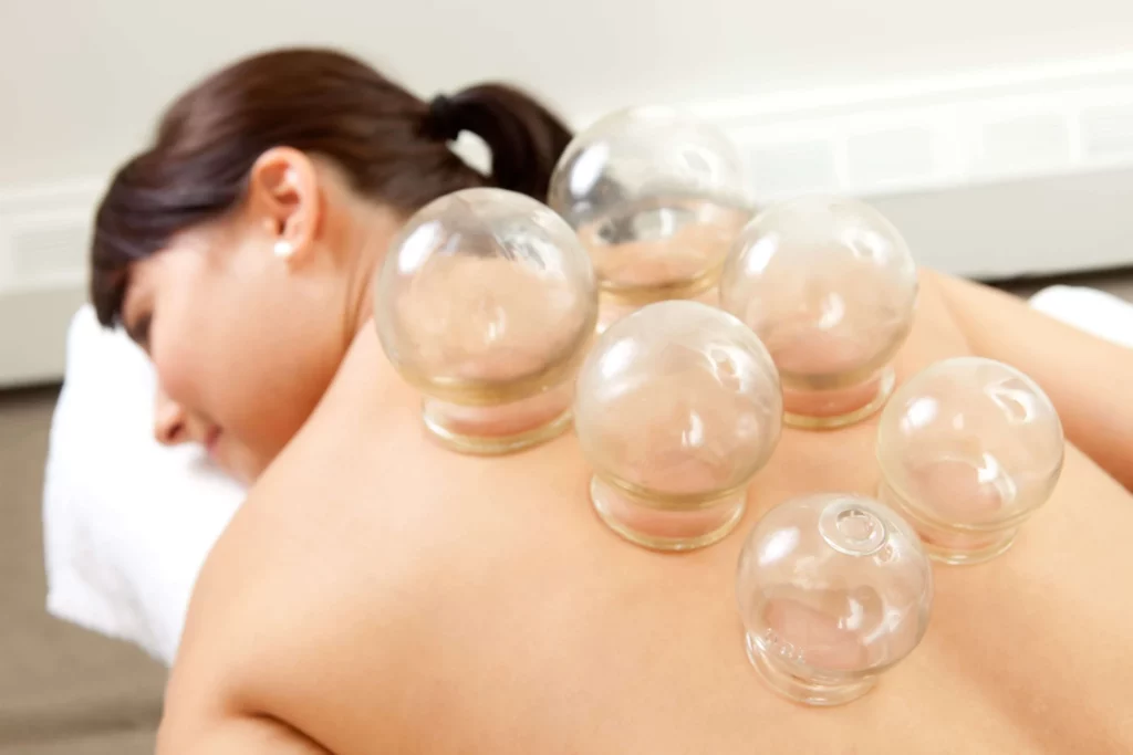 fire cupping Newport beach Orange county